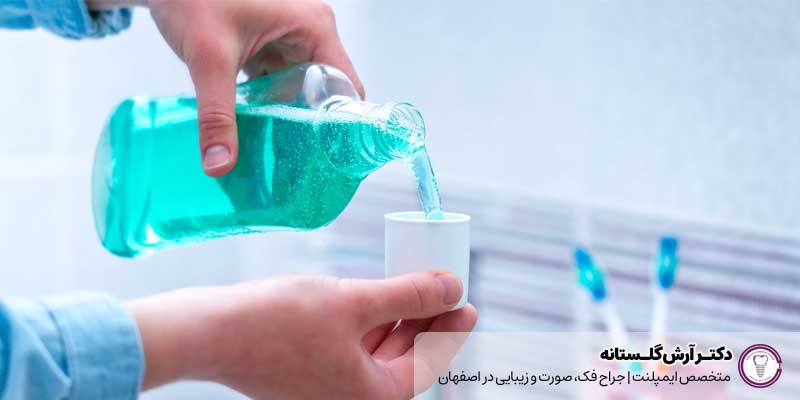 دهان‌شویه‌های مخصوص ایمپلنت |دکتر آرش گلستانه جراح فک و صورت در اصفهان