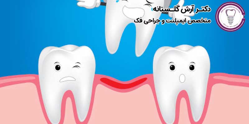 دلایل از دست دادن دندان