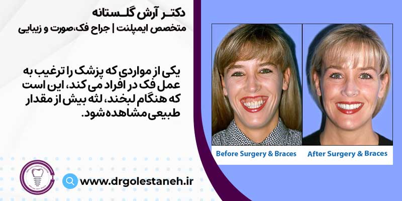 جراح فک و صورت در اصفهان
