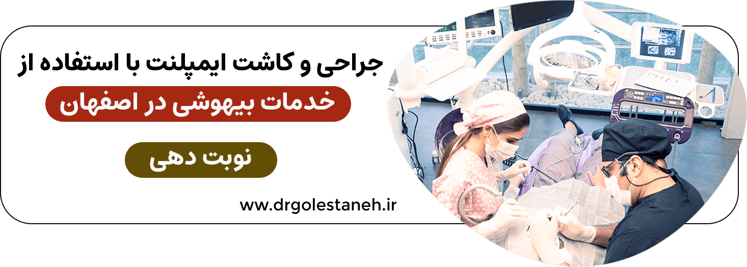 مشاوره آنلاین جهت کاشت ایمپلنت با استفاده از خدمات بیهوشی و سدیشن در اصفهان توسط دکار آرش گلستانه
