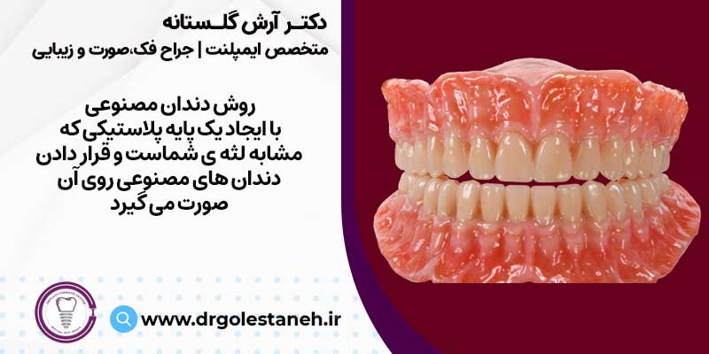 دندان مصنوعی یکی از روش های کاشت دندان بدون ایمپلنت