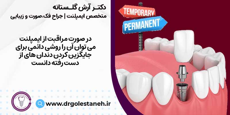 کاشت دندان دائمی با ایمپلنت دندان