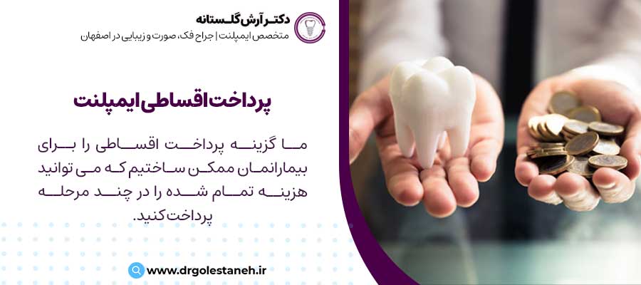 پرداخت اقساطی ایمپلنت | دکتر آرش گلستانه متخصص ایمپلنت در اصفهان