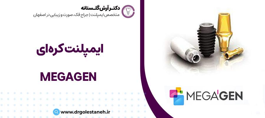 ایمپلنت کره ای مگاژن (Megagen) | دکتر آرش گلستانه متخصص ایمپلنت در اصفهان