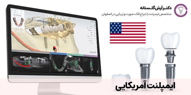 ایمپلنت آمریکایی | دکتر آرش گلستانه متخصص ایمپلنت در اصفهان