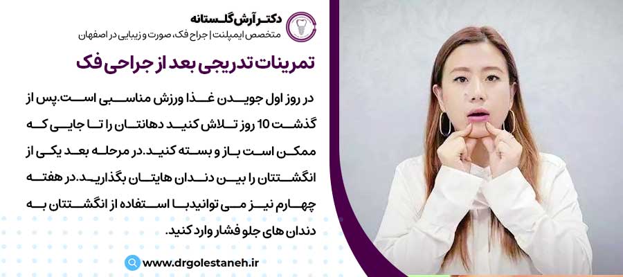 تمرینات تدریجی بعد از جراحی فک |دکتر آرش گلستانه جراح فک و صورت در اصفهان