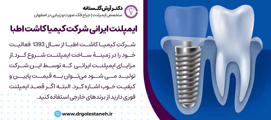 ایمپلنت ایرانی شرکت کیمیا کاشت اطبا |دکتر آرش گلستانه متخصص ایمپلنت در اصفهان