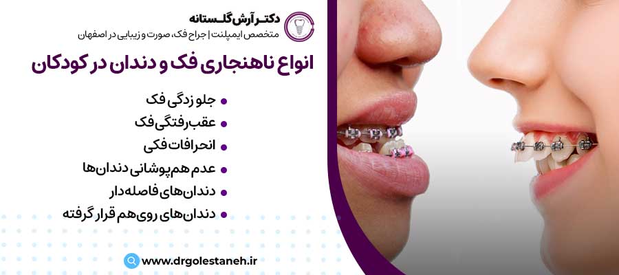 انواع ناهنجاری‌های فک و دندان در کودکان |دکتر آرش گلستانه جراح فک و صورت در اصفهان