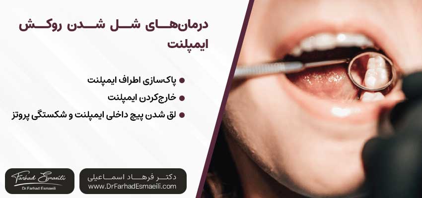 درمان‌های شل‌ شدن روکش ایمپلنت |دکتر آرش گلستانه جراح فک و صورت در اصفهان