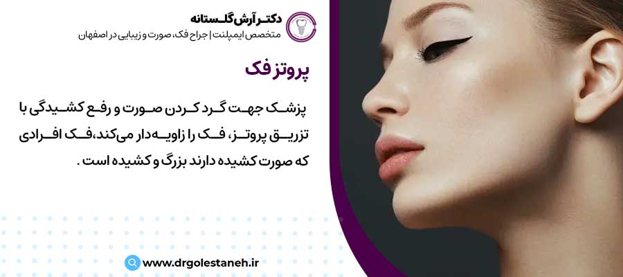 پروتز فک |دکتر آرش گلستانه جراح فک و صورت در اصفهان