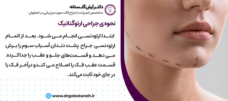 نحوه جراحی ارتوگناتیک |دکتر آرش گلستانه جراح فک و صورت در اصفهان 
