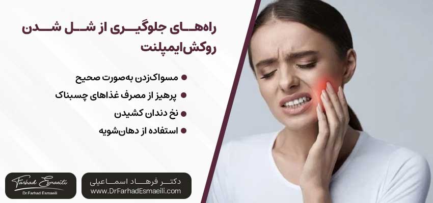 راه‌های جلوگیری از شل‌ شدن روکش ایمپلنت |دکتر آرش گلستانه جراح فک و صورت در اصفهان