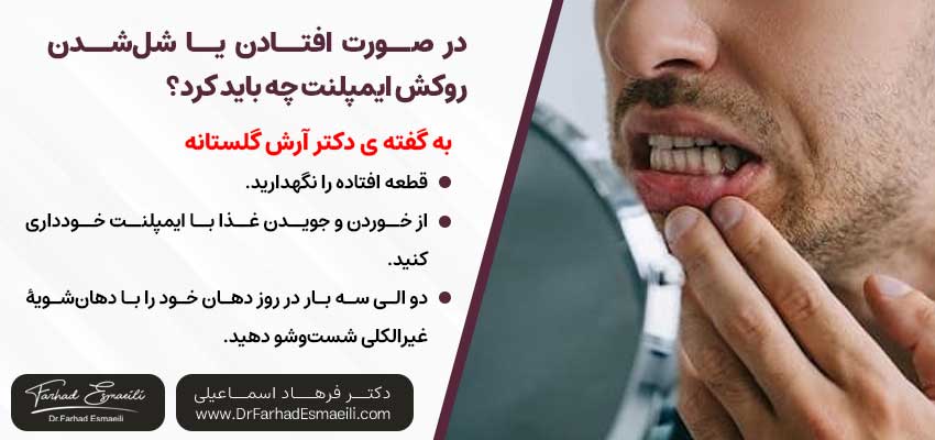 در صورت افتادن یا شل‌شدن روکش ایمپلنت چه باید کرد؟ |دکتر آرش گلستانه جراح فک و صورت در اصفهان