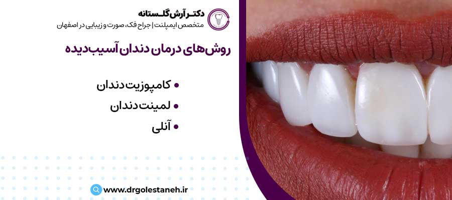  انواع روش‌های درمانی دندان آسیب‌دیده چیست؟|دکتر آرش گلستانه جراح فک و صورت در اصفهان 