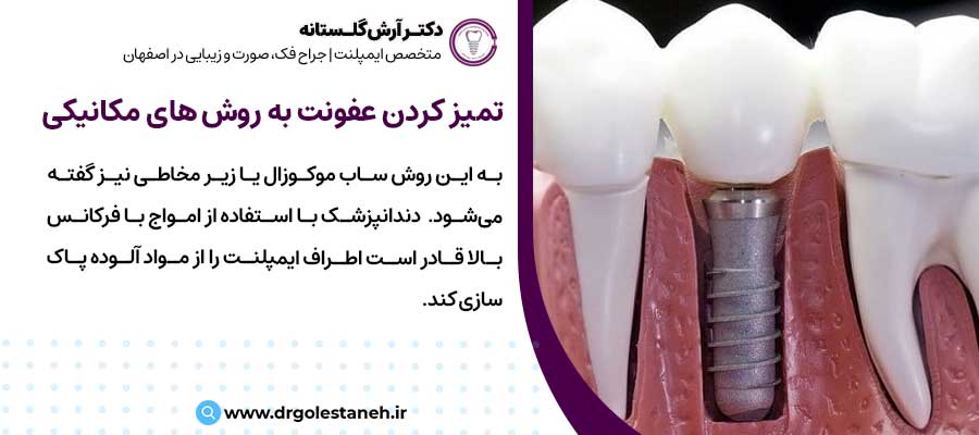 تمیز کردن عفونت به روش های مکانیکی |دکتر آرش گلستانه جراح فک و صورت در اصفهان