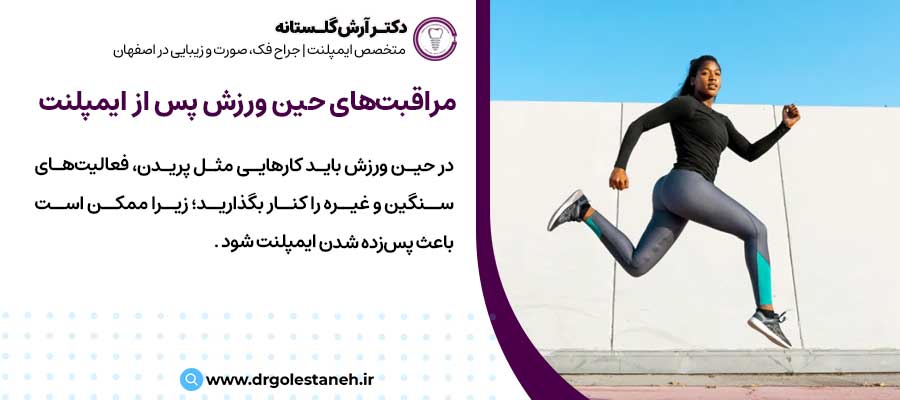 مراقبت‌های حین ورزش پس از کاشت ایمپلنت چیست؟ |دکتر آرش گلستانه جراح فک و صورت در اصفهان