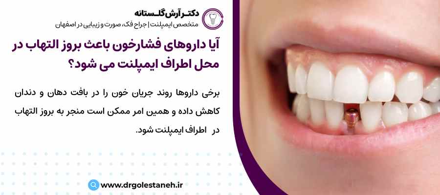 آیا مصرف داروهای فشارخون می‌تواند باعث بروز التهاب در دندان‌های اطراف ایمپلنت شود؟ 