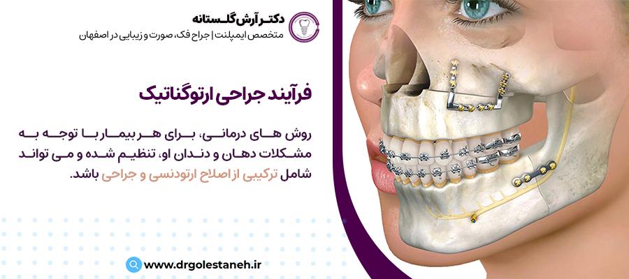 فرآیند جراحی ارتوگناتیک | دکتر آرش گلستانه یکی از بهترین متخصص های دندانپزشکی در اصفهان