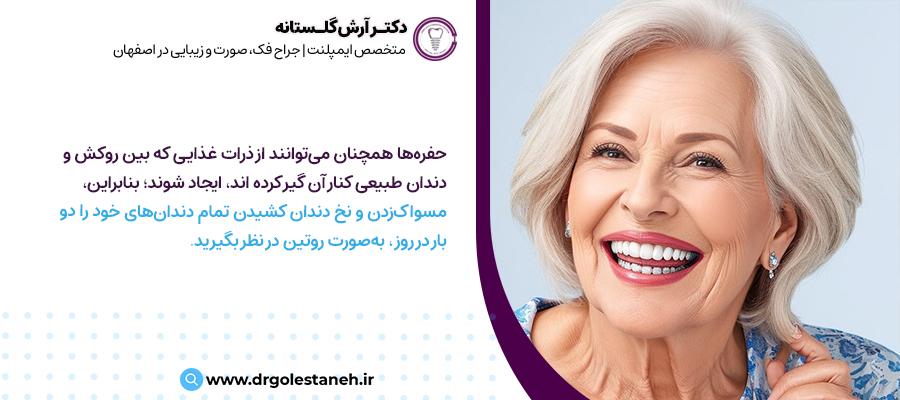 مراقبت از اوردنچر و ایمپلنت دندان | مرکز دندانپزشکی دکتر آرش گلستانه در اصفهان