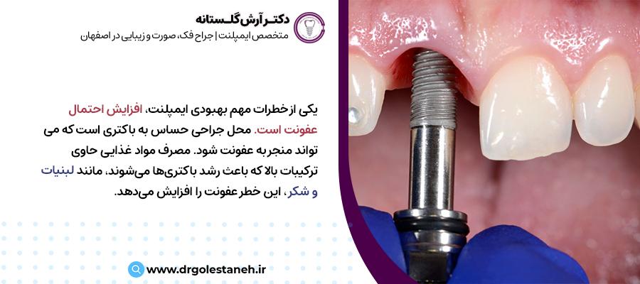 عفونت ایمپلنت دندان | مرکز دندانپزشکی دکتر آرش گلستانه