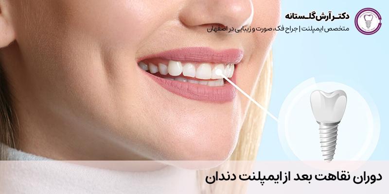 دوران نقاهت بعد از ایمپلنت دندان | مرکز دندانپزشکی ترمیمی اصفهان با مدیریت دکتر آرش گلستانه