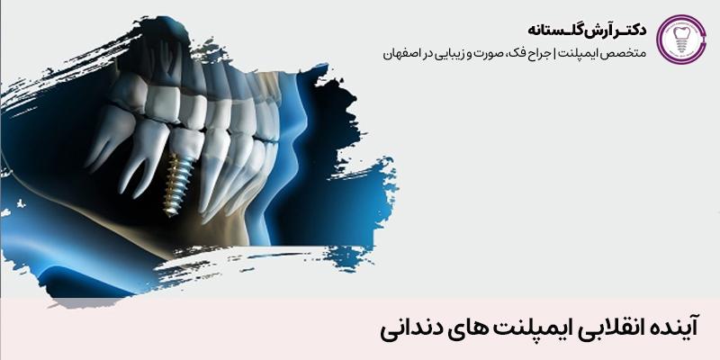 آینده انقلابی ایمپلنت های دندانی | مرکز ایمپلنت دندان دکتر آرش گلستانه در اصفهان