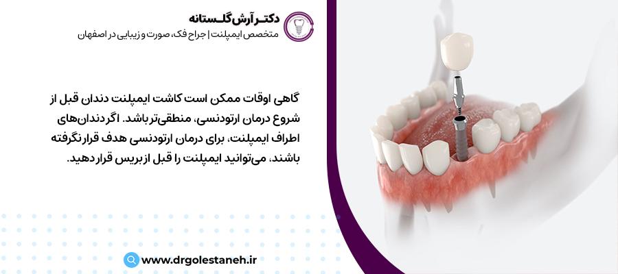 درمان ارتودنسی بعد از ایمپلنت دندان | مرکز ایمپلنت دکتر آرش گلستانه در اصفهان