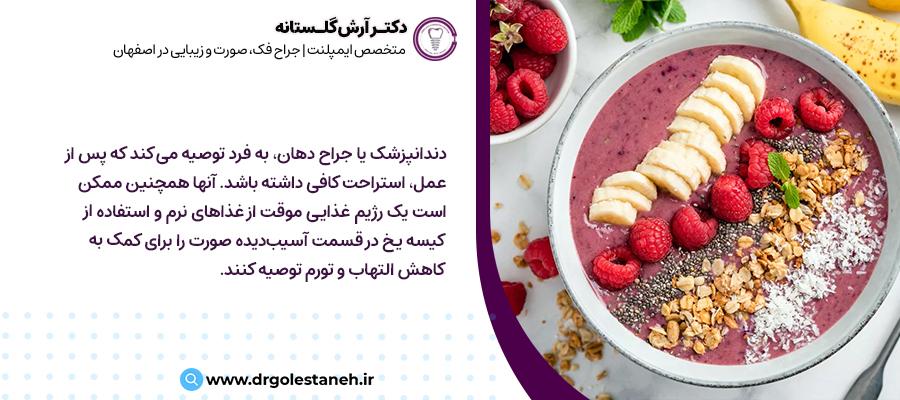 غذا های مناسب ایمپلنت دندان | دکتر آرش گلستانه در اصفهان
