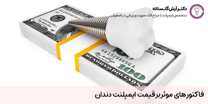 فاکتور های موثر بر قیمت ایمپلنت دندان | مرکز ایمپلنت دندان دکتر آرش گلستانه در اصفهان