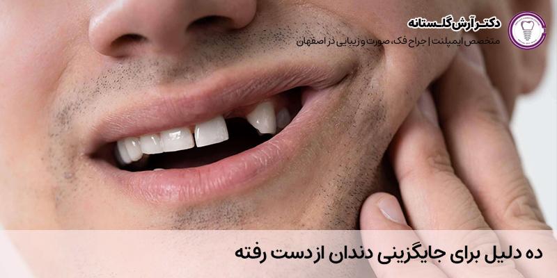 10 دلیل برای جایگزینی دندان از دست رفته | دکتر آرش گلستانه