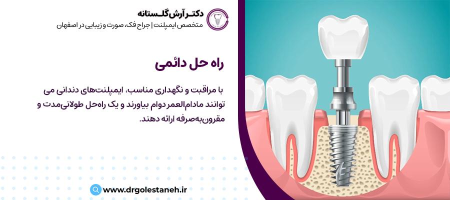 دوام و ماندگاری ایمپلنت دندان | مرکز ایمپلنت دکتر آرش گلستانه در اصفهان
