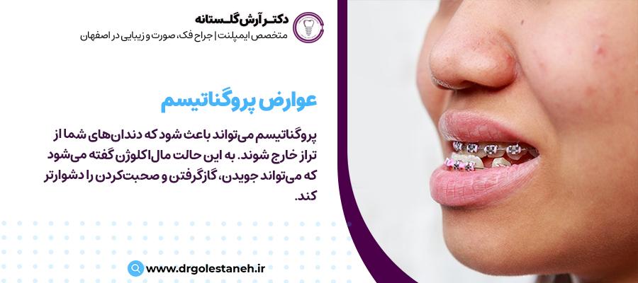 عوارض پروگناتیسم | مرکز جراحی دهان دکتر آرش گلستانه