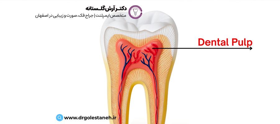 پالپ دندان | مرکز دندانپزشکی دکتر آرش گلستانه