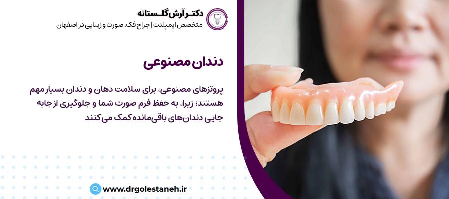 دندان مصنوعی | مطب دکتر آرش گلستانه