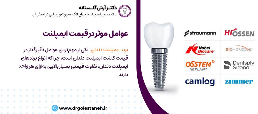 عوامل موثر بر قیمت ایمپلنت دندان | مرکز ایمپلنت دیجیتال دکتر آرش گلستانه در اصفهان