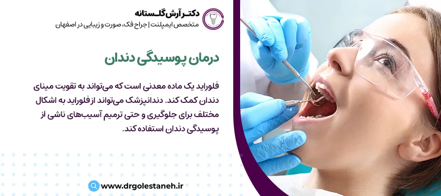 درمان پوسیدگی دندان | مرکز دندانپزشکی دکتر آرش گلستانه