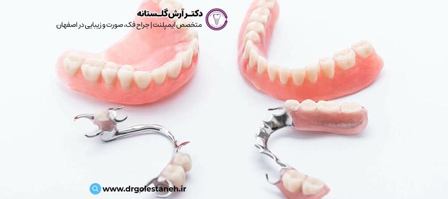 دندان مصنوعی تکه ای | سایت دکتر آرش گلستانه در اصفهان