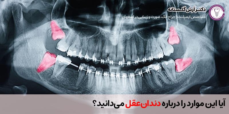 آیا این موارد را درباره دندان‌عقل می‌دانید؟ | دکتر آرش گلستانه