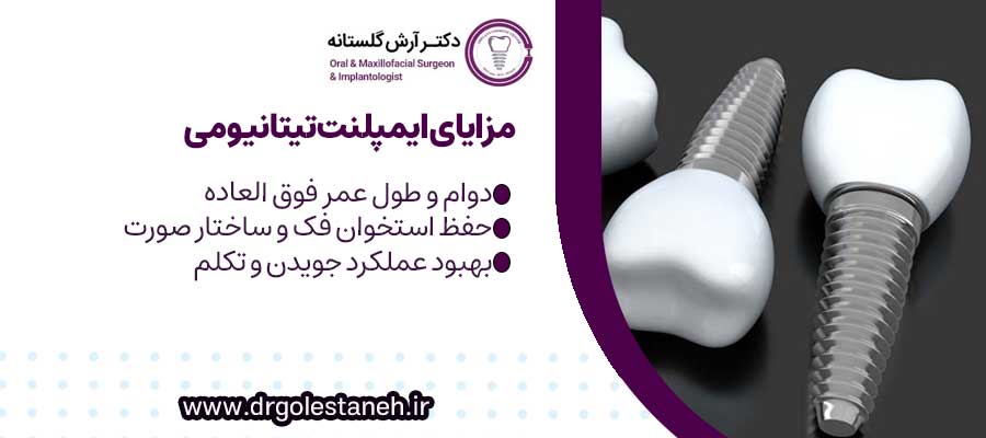 مزایای ایمپلنت تیتانیومی