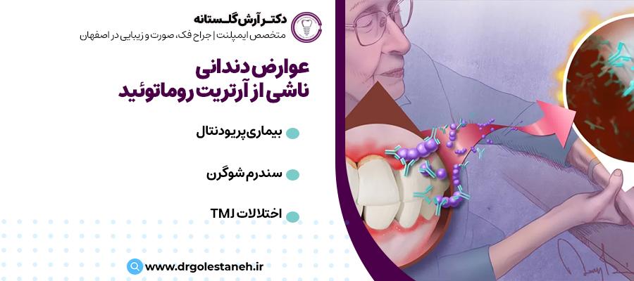 عوارض دندانی ناشی از آرتریت روماتوئید | دکتر آرش گلستانه