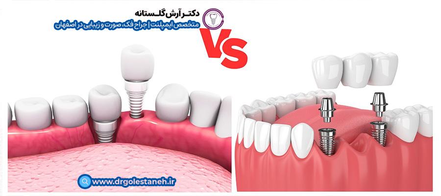 ایمپلنت های تیتانیومی در مقایسه با ایمپلنت های سرامیکی | دکتر آرش گلستانه