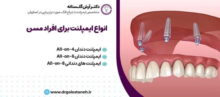 انواع ایمپلنت‌های دندانی برای افراد مسن | دکتر آرش گلستانه در اصفهان