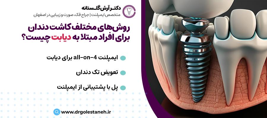 روش‌های مختلف کاشت دندان، برای افراد مبتلا به دیابت چیست؟ | دکتر آرش گلستانه