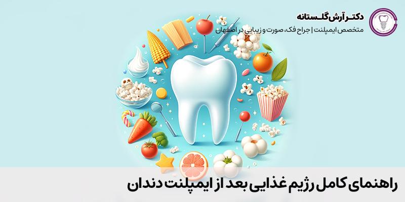 راهنمای کامل رژیم غذایی بعد از ایمپلنت دندان | دکتر آرش گلستانه