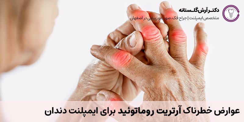 عوارض خطرناک آرتریت روماتوئید برای ایمپلنت دندان | دکتر آرش گلستانه