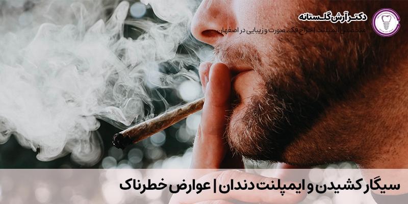 سیگار کشیدن و ایمپلنت دندان | عوارض خطرناک | دکتر آرش گلستانه