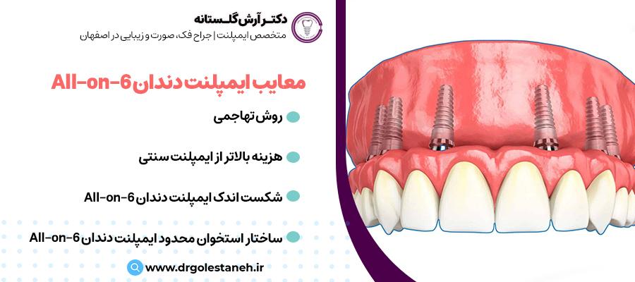 معایب ایمپلنت دندان All-on-6 | دکتر آرش گلستانه