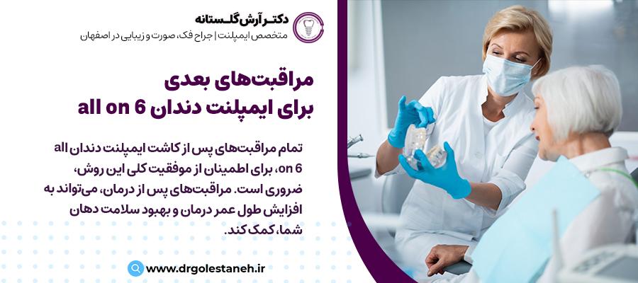 مراقبت‌های بعدی برای ایمپلنت دندان all on 6 | دکتر آرش گلستانه