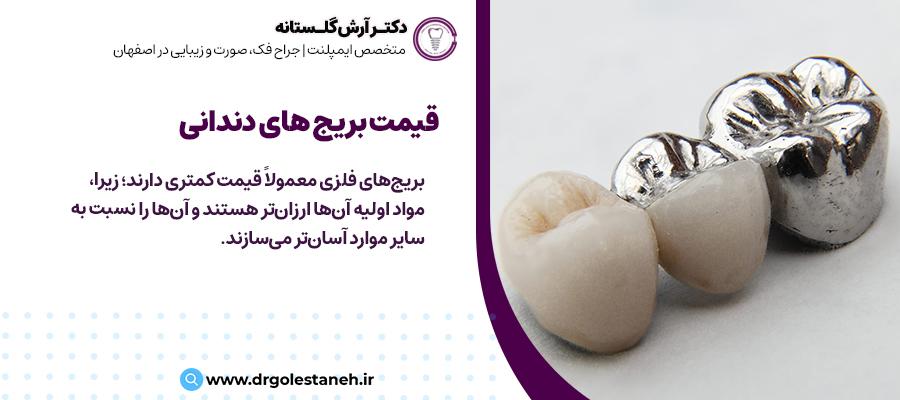 مقایسه قیمت انواع بریج دندان | دکتر آرش گلستانه