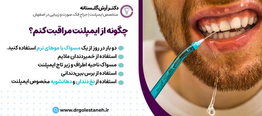 چگونه از ایمپلنت مراقبت کنم؟ | دکتر آرش گلستانه